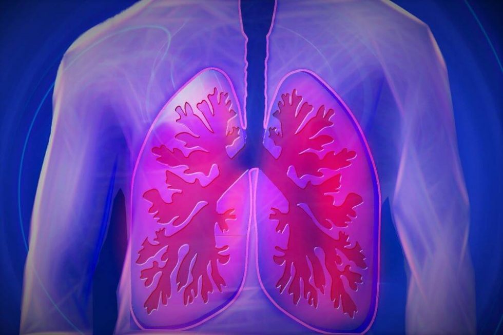 What Is Asbestosis Symptoms Treatment And Prevention Haztrainer