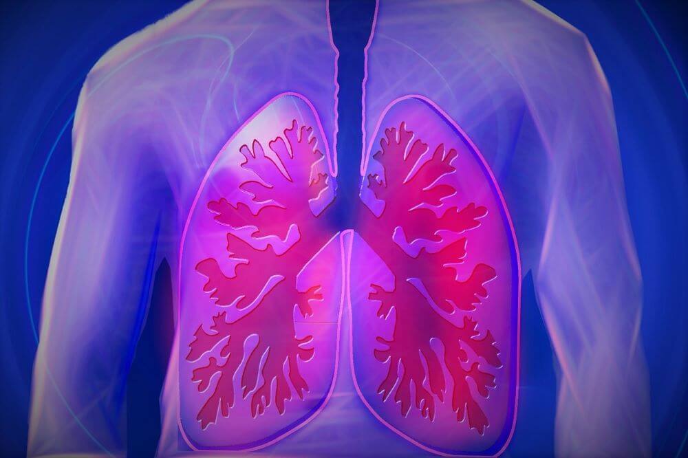 What Is Asbestosis? Symptoms, Treatment, and Prevention.